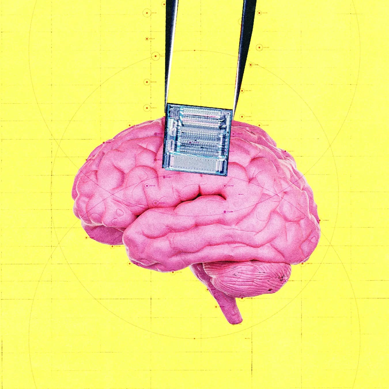OpenAI инвестирует в стартап, который использует мозговые имплантаты для обнаружения рака